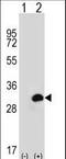 Carbonic Anhydrase 1 antibody, LS-C168231, Lifespan Biosciences, Western Blot image 