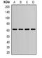 Prolyl 4-Hydroxylase Subunit Beta antibody, orb340714, Biorbyt, Western Blot image 