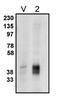 Phospholipid Phosphatase 2 antibody, orb108865, Biorbyt, Western Blot image 