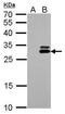 Kallikrein Related Peptidase 7 antibody, PA5-21499, Invitrogen Antibodies, Western Blot image 