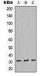 Neutrophil Cytosolic Factor 1 antibody, orb256707, Biorbyt, Western Blot image 