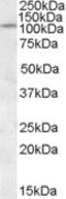 Protein Tyrosine Phosphatase Receptor Type N antibody, MBS421847, MyBioSource, Western Blot image 