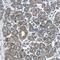 Branched Chain Keto Acid Dehydrogenase Kinase antibody, PA5-53697, Invitrogen Antibodies, Immunohistochemistry frozen image 
