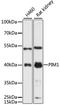 Pim-1 Proto-Oncogene, Serine/Threonine Kinase antibody, LS-C749218, Lifespan Biosciences, Western Blot image 