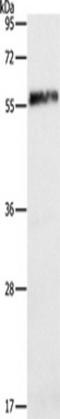 HEXIM P-TEFb Complex Subunit 1 antibody, TA349449, Origene, Western Blot image 