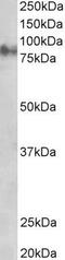 Junction Plakoglobin antibody, GTX11799, GeneTex, Western Blot image 