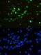 Heterogeneous Nuclear Ribonucleoprotein F antibody, A05806, Boster Biological Technology, Immunofluorescence image 