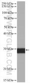 Calbindin 2 antibody, HRP-66496, Proteintech Group, Western Blot image 