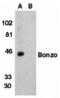 C-X-C Motif Chemokine Receptor 6 antibody, 2209, QED Bioscience, Western Blot image 