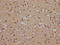 SRY-Box 10 antibody, CSB-RA592917A0HU, Cusabio, Immunohistochemistry paraffin image 