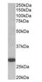 Thyroid Stimulating Hormone Receptor antibody, orb125215, Biorbyt, Western Blot image 