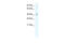 Tumor Susceptibility 101 antibody, 28-758, ProSci, Western Blot image 