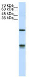 High Mobility Group AT-Hook 2 antibody, TA343411, Origene, Western Blot image 