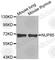 Nucleoporin 85 antibody, A3504, ABclonal Technology, Western Blot image 