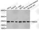 Transmembrane P24 Trafficking Protein 3 antibody, A3394, ABclonal Technology, Western Blot image 