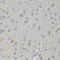 NME/NM23 Nucleoside Diphosphate Kinase 1 antibody, 13-111, ProSci, Immunohistochemistry frozen image 