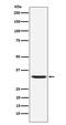 Hepcidin Antimicrobial Peptide antibody, M01347, Boster Biological Technology, Western Blot image 