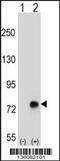 Transforming Growth Factor Beta Induced antibody, MBS9203004, MyBioSource, Western Blot image 