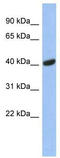 Siah E3 Ubiquitin Protein Ligase 2 antibody, TA333954, Origene, Western Blot image 