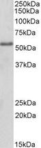 Forkhead Box C1 antibody, GTX89469, GeneTex, Western Blot image 