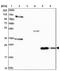 Interleukin 17B antibody, NBP1-83113, Novus Biologicals, Western Blot image 