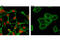 Androgen Receptor antibody, 8938S, Cell Signaling Technology, Immunocytochemistry image 