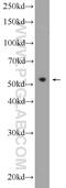 Programmed Cell Death 7 antibody, 12485-1-AP, Proteintech Group, Western Blot image 