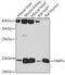 Fatty Acid Binding Protein 4 antibody, GTX54016, GeneTex, Western Blot image 