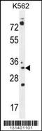 Pyrroline-5-Carboxylate Reductase 2 antibody, 56-080, ProSci, Western Blot image 