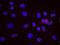 ATM Serine/Threonine Kinase antibody, NB100-678, Novus Biologicals, Proximity Ligation Assay image 