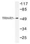 Thyrotropin Releasing Hormone Receptor antibody, AP01441PU-N, Origene, Western Blot image 