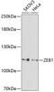 Zinc Finger E-Box Binding Homeobox 1 antibody, GTX33589, GeneTex, Western Blot image 