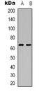mRNA-decapping enzyme 1A antibody, orb338893, Biorbyt, Western Blot image 
