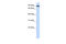 Transferrin Receptor 2 antibody, ARP45441_P050, Aviva Systems Biology, Western Blot image 