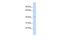 Endoplasmic reticulum-Golgi intermediate compartment protein 2 antibody, GTX48957, GeneTex, Western Blot image 