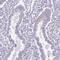 Adaptor Related Protein Complex 1 Subunit Sigma 2 antibody, PA5-62081, Invitrogen Antibodies, Immunohistochemistry frozen image 