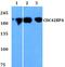 CDC42 Binding Protein Kinase Alpha antibody, PA5-75816, Invitrogen Antibodies, Western Blot image 