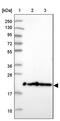 Transmembrane Protein 126A antibody, PA5-61272, Invitrogen Antibodies, Western Blot image 