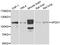 AP-2 complex subunit alpha-1 antibody, abx007190, Abbexa, Western Blot image 