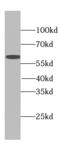 AGRINL antibody, FNab06453, FineTest, Western Blot image 