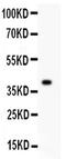 Minichromosome Maintenance Complex Component 7 antibody, PA5-79651, Invitrogen Antibodies, Western Blot image 