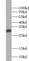 TPS1 antibody, FNab08904, FineTest, Western Blot image 