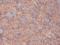 Gamma-Aminobutyric Acid Type A Receptor Beta3 Subunit antibody, SMC-339D-FITC, StressMarq, Immunohistochemistry paraffin image 