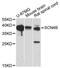 Sodium Voltage-Gated Channel Beta Subunit 4 antibody, MBS127969, MyBioSource, Western Blot image 