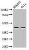 Lysophosphatidylglycerol Acyltransferase 1 antibody, CSB-PA821685LA01HU, Cusabio, Western Blot image 