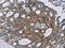 Mitochondrial Ribosomal Protein L39 antibody, CSB-PA223569, Cusabio, Immunohistochemistry paraffin image 