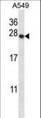 Proteasome 26S Subunit, Non-ATPase 9 antibody, LS-C162247, Lifespan Biosciences, Western Blot image 