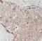 Ribosomal Protein S16 antibody, FNab07462, FineTest, Immunohistochemistry paraffin image 