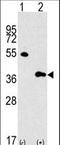 MTOR Associated Protein, LST8 Homolog antibody, LS-C100970, Lifespan Biosciences, Western Blot image 