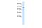 Smad Nuclear Interacting Protein 1 antibody, PA5-40742, Invitrogen Antibodies, Western Blot image 